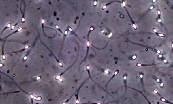 1sperm,abstract,abstraction,bokeh,cell,2560x1536 px