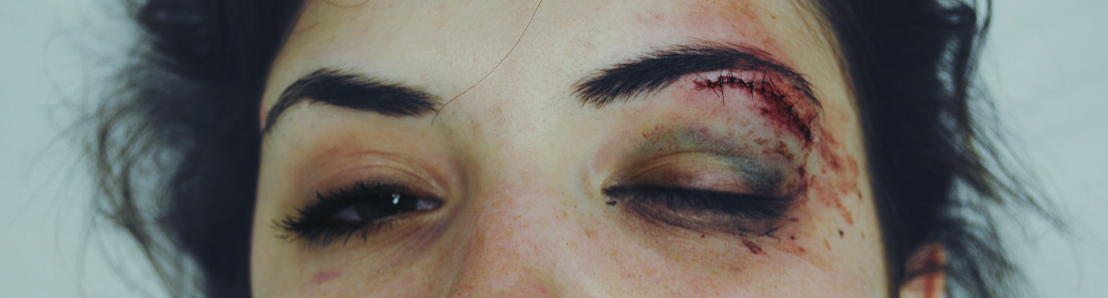 ansigt, portræt, værelse, rød, fotografering, lilla, grøn, blå, blod, hår, Nikon, næse, Sygehus, øjenbryn, hoved, sømme, farve, skønhed, øje, nødsituation, digital, læbe, kind, smuk, afgrøde, øjenbryn, menneskelige legeme, organ, tæt på, øjenvipper, eyelash extensions, blåt mærke, pande, sår, skade